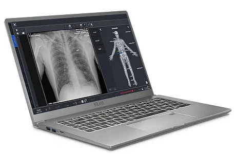 рентгеновский аппарат Dixion Remodix 9507