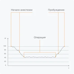 AI индекс