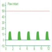 Портативный аппарат ИВЛ AII6000B