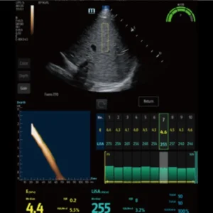 Mindray Hepatus 5