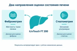 Аппарат для эластографии печени